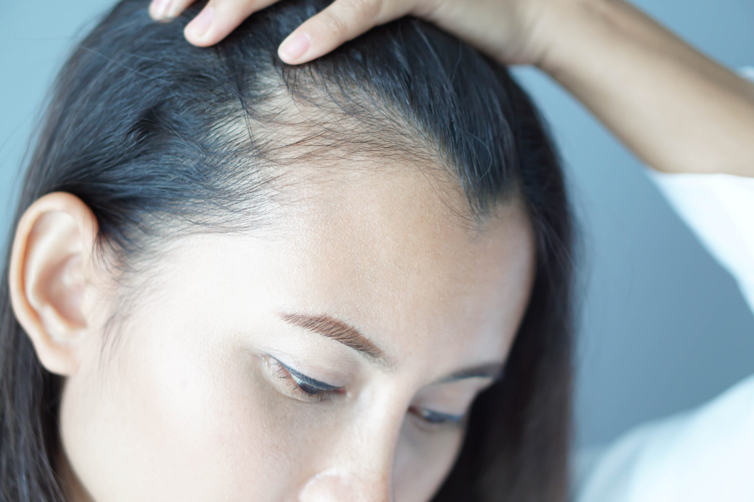Suivi post opératoire greffe de cheveux Greffe de Cheveux